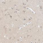 NDE1 Polyclonal Antibody