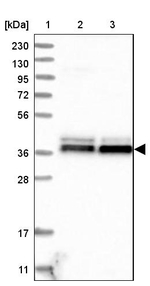 NDE1 Antibody in Western Blot (WB)