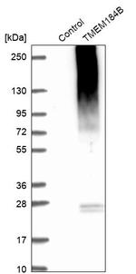 TMEM184B Antibody in Western Blot (WB)