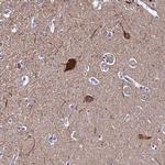 CEP41 Polyclonal Antibody