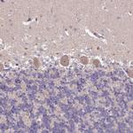 SETX Antibody in Immunohistochemistry (Paraffin) (IHC (P))