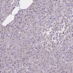 SETX Antibody in Immunohistochemistry (Paraffin) (IHC (P))