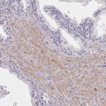 SETX Antibody in Immunohistochemistry (Paraffin) (IHC (P))