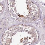 SETX Antibody in Immunohistochemistry (Paraffin) (IHC (P))