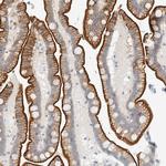 FAM132A Antibody in Immunohistochemistry (Paraffin) (IHC (P))
