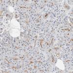 FAM132A Antibody in Immunohistochemistry (Paraffin) (IHC (P))