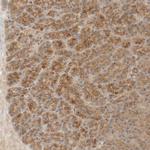 TMEM192 Antibody in Immunohistochemistry (IHC)