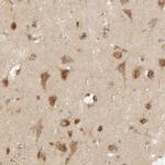 TMEM192 Antibody in Immunohistochemistry (IHC)