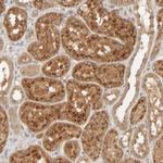 TMEM192 Antibody in Immunohistochemistry (IHC)
