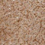 TMEM192 Antibody in Immunohistochemistry (IHC)