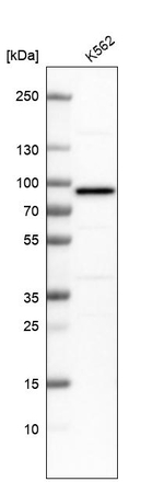 PUS7 Antibody in Western Blot (WB)