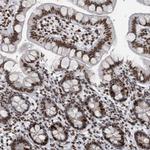 TOP2B Antibody in Immunohistochemistry (Paraffin) (IHC (P))