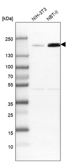 TOP2B Antibody in Western Blot (WB)