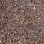 UGCG Antibody in Immunohistochemistry (IHC)