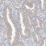 UGCG Antibody in Immunohistochemistry (IHC)
