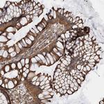 KIF12 Polyclonal Antibody