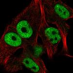 CCDC171 Antibody in Immunocytochemistry (ICC/IF)