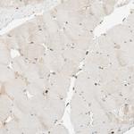 CCDC171 Antibody in Immunohistochemistry (Paraffin) (IHC (P))