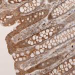 VSTM2A Polyclonal Antibody