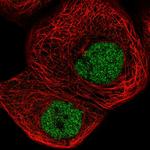 ZBTB11 Polyclonal Antibody