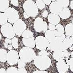 ZBTB11 Antibody in Immunohistochemistry (IHC)