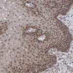 CWC27 Antibody in Immunohistochemistry (Paraffin) (IHC (P))