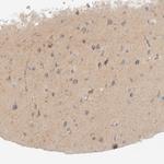 CHKA Antibody in Immunohistochemistry (Paraffin) (IHC (P))