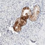 CHKA Antibody in Immunohistochemistry (Paraffin) (IHC (P))