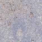 CHKA Antibody in Immunohistochemistry (Paraffin) (IHC (P))