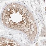 CHKA Antibody in Immunohistochemistry (Paraffin) (IHC (P))