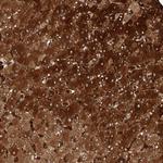 ZNF862 Antibody in Immunohistochemistry (Paraffin) (IHC (P))