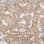 HDHD3 Antibody in Immunohistochemistry (IHC)