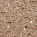 WDR32 Antibody in Immunohistochemistry (Paraffin) (IHC (P))