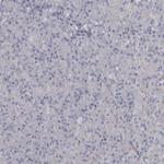 PPP1R12B Polyclonal Antibody
