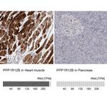 PPP1R12B Antibody
