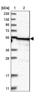 TRIT1 Antibody in Western Blot (WB)