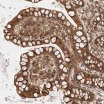 SIKE Antibody in Immunohistochemistry (Paraffin) (IHC (P))