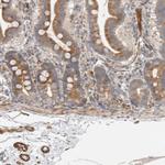 SIPA1L2 Polyclonal Antibody