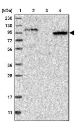 SIPA1L2 Antibody in Western Blot (WB)
