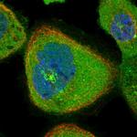 RIOK3 Polyclonal Antibody