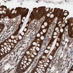 RIOK3 Antibody in Immunohistochemistry (Paraffin) (IHC (P))