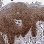 RIOK3 Antibody in Immunohistochemistry (Paraffin) (IHC (P))