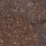 RIOK3 Antibody in Immunohistochemistry (Paraffin) (IHC (P))