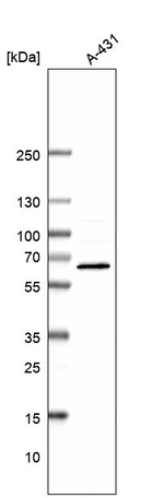 RIOK3 Antibody in Western Blot (WB)