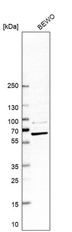 PGM1 Antibody in Western Blot (WB)