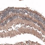 C8orf37 Antibody in Immunohistochemistry (Paraffin) (IHC (P))