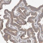 C8orf37 Antibody in Immunohistochemistry (Paraffin) (IHC (P))