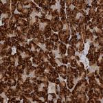 NXT2 Antibody in Immunohistochemistry (Paraffin) (IHC (P))