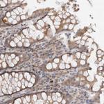 NXT2 Antibody in Immunohistochemistry (Paraffin) (IHC (P))