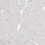 NXT2 Polyclonal Antibody